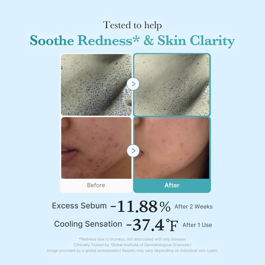 Medicube Azelaic Acid Niacinamide Toner – Calming & Clarifying, 4% Azelaic Acid + 2% Niacinamide, 8.45 fl oz