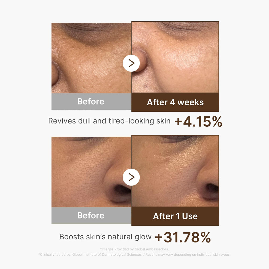 Medicube Deep Vitamin C Capsule Serum | Hydrating Vitamin C Serum for Dull & Uneven Skin | Liposome Capsule Technology | Korean Skincare 1.01 fl oz
