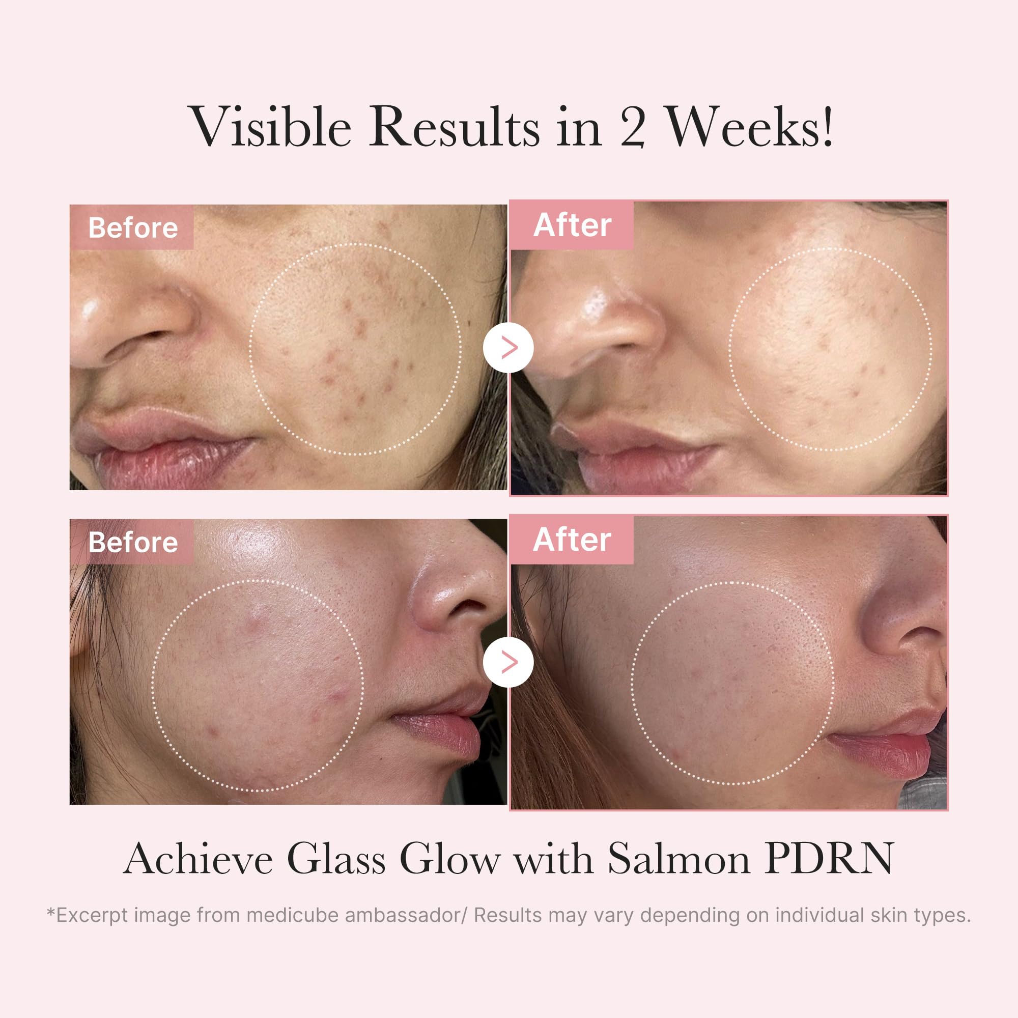 Medicube Salmon DNA PDRN Trial Kit – Glass Glow Mini Skincare Set with Toner, Serum & Sheet Mask